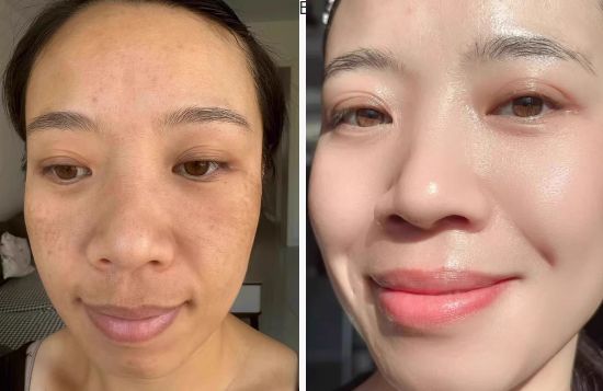 Aglaiwish  КРЕМ ПРОТИ ЗМОРШОК