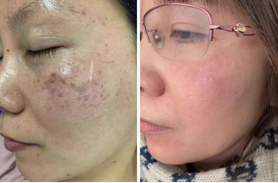 Aglaiwish  КРЕМ ПРОТИ ЗМОРШОК